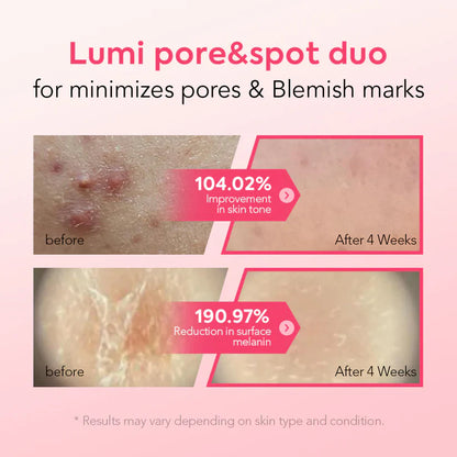 Cougex™ Pore & Spot Care Duo – Instantly Tightens Pores & Fades Dark Spots